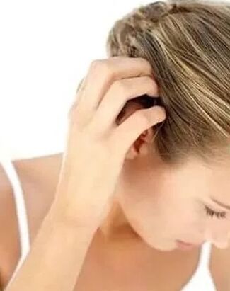 Psoriasis treatment