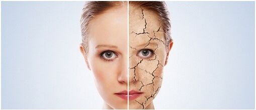 We treat psoriasis