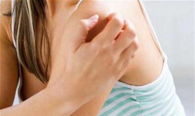 girl scratching her shoulder